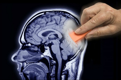 تحریک الکتریکی مغز انسان می تواند خاطرات از یاد رفته را بازیابی کند
